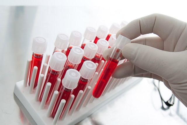 Ποια ομάδα αίματος κινδυνεύει περισσότερο από σοβαρή λοίμωξη Covid-19