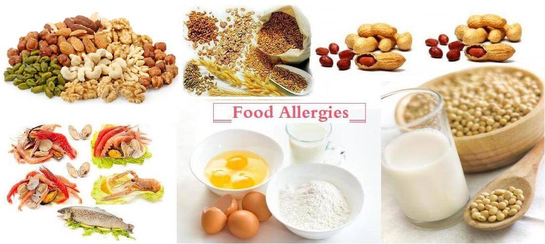 Τροφική αλλεργία: Τι είναι και πώς αντιμετωπίζεται