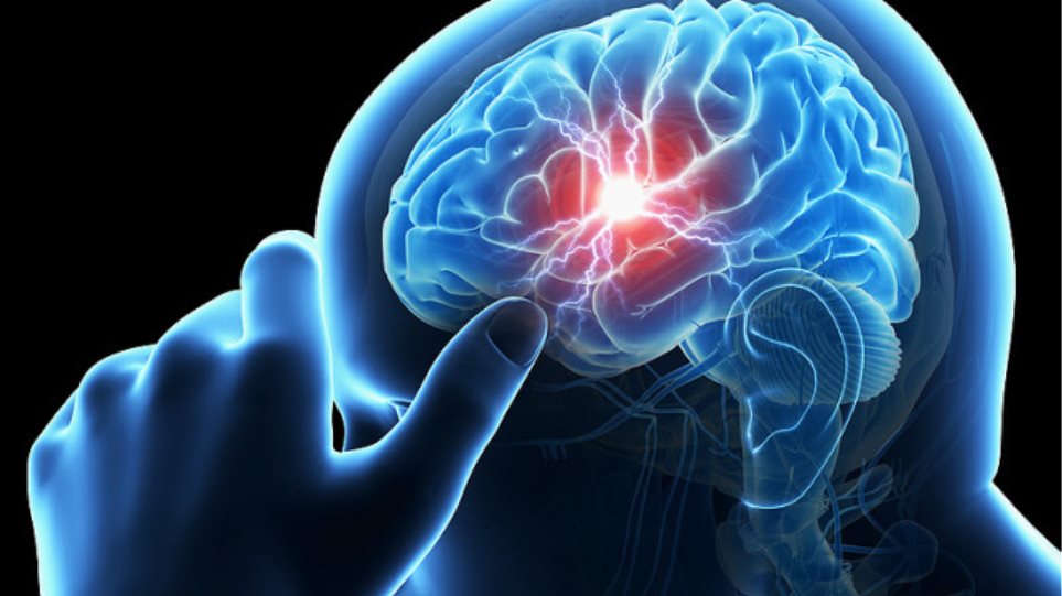 Εγκεφαλικό επεισόδιο: Τα πρώτα συμπτώματα και η νέα επέμβαση